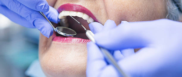 Best Emergency Root Canal Treatment in Worthington, OH